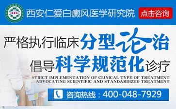 西安治疗白癜风到哪家医院