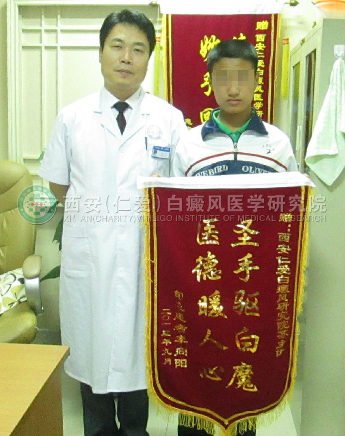 男孩一年的白癜风在我院三个月治好.jpg
