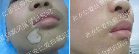 ������̬ ������ӭ������δ��