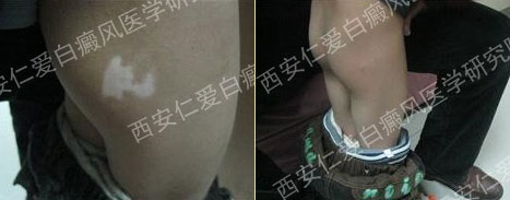 СС�������ֹ���̬����˰���