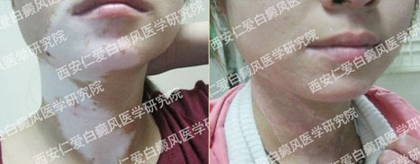 ����Ů���ĳɹ�����֮�� 