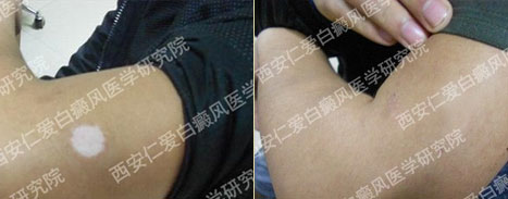 �����ɹ����֣�С������Ѱ�»�