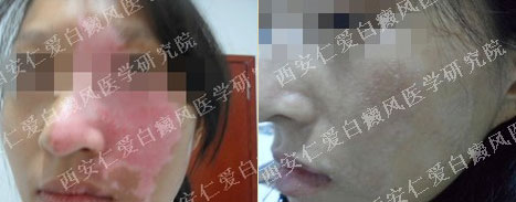 ������ʧ�ˣ�Ц���������� 