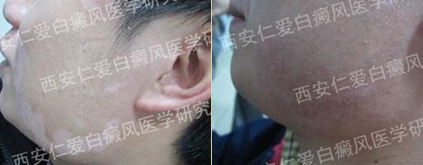 ѡ�������ʰ� ���򽡿����ŵ�δ��